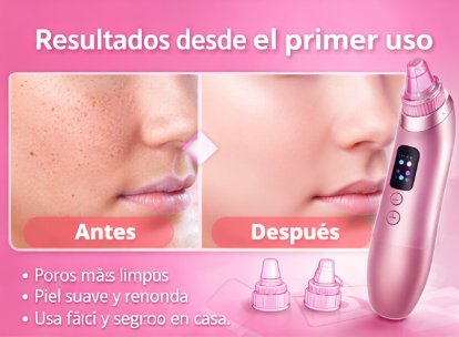 AquaClean Pro – Removedor de Puntos Negros Profesional